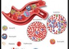 Cara Ampuh Mengobati Leukemia Dengan Melia Propolis